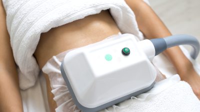 cryolipolyse