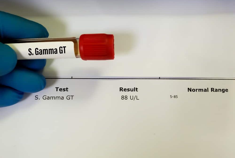 gamma-gt-echantillon