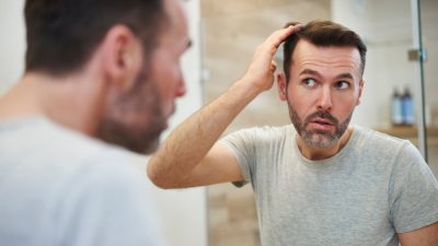 homme-mature-hairline
