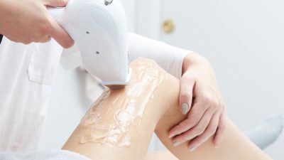epilation-laser