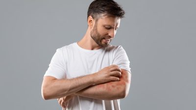 homme souffrant psoriasis