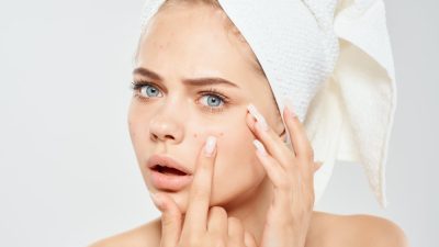 femme adulte bouton acne